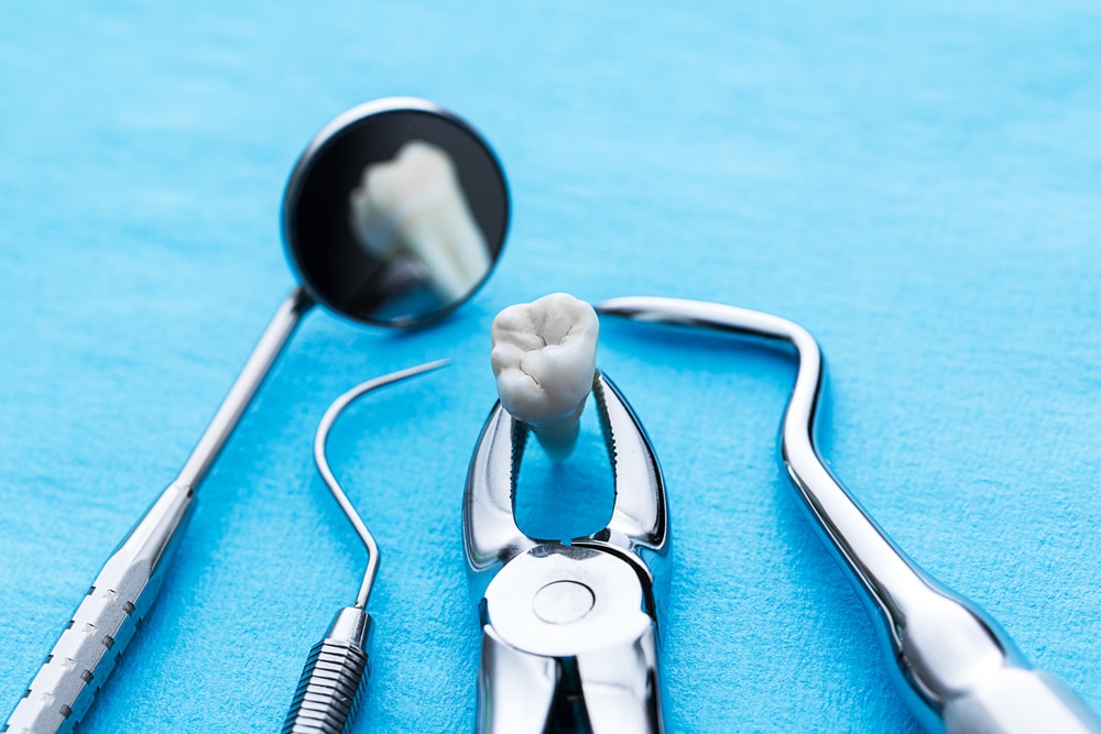More complex procedure, which is used if a tooth may have broken off at the gum line or has not erupted in the mouth. The oral surgeon will make a small incision into your gum to surgically remove the broken tooth or impacted wisdom tooth.