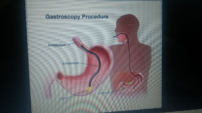 Gastroscopy