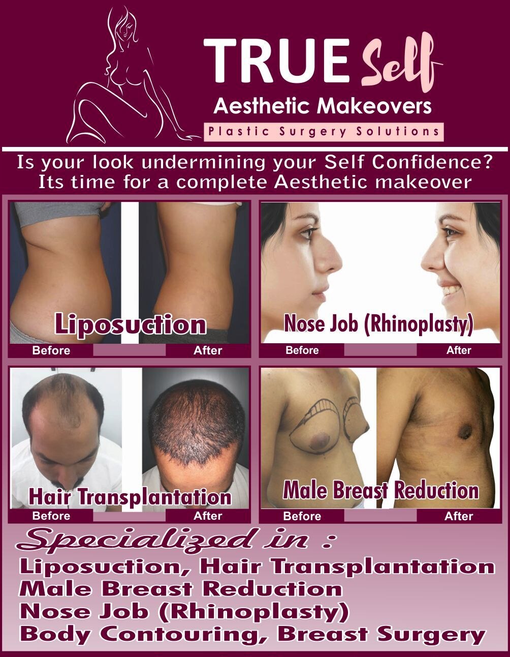 COSMETIC PLASTIC SURGERY
AESTHETIC SURGERY
HAIR LOSS TREATMENT
MALE BREAST REDUCTION
BODY FAT REMOVAL