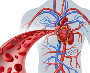 Peripheral vascular disease (P