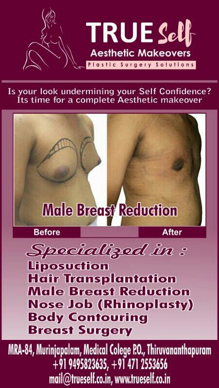 Gynecomastia Liposuction
