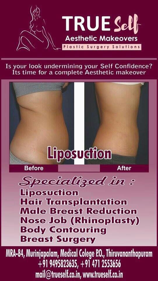Liposuction
