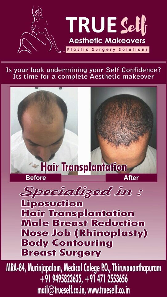 PRP / Hair Transplantation