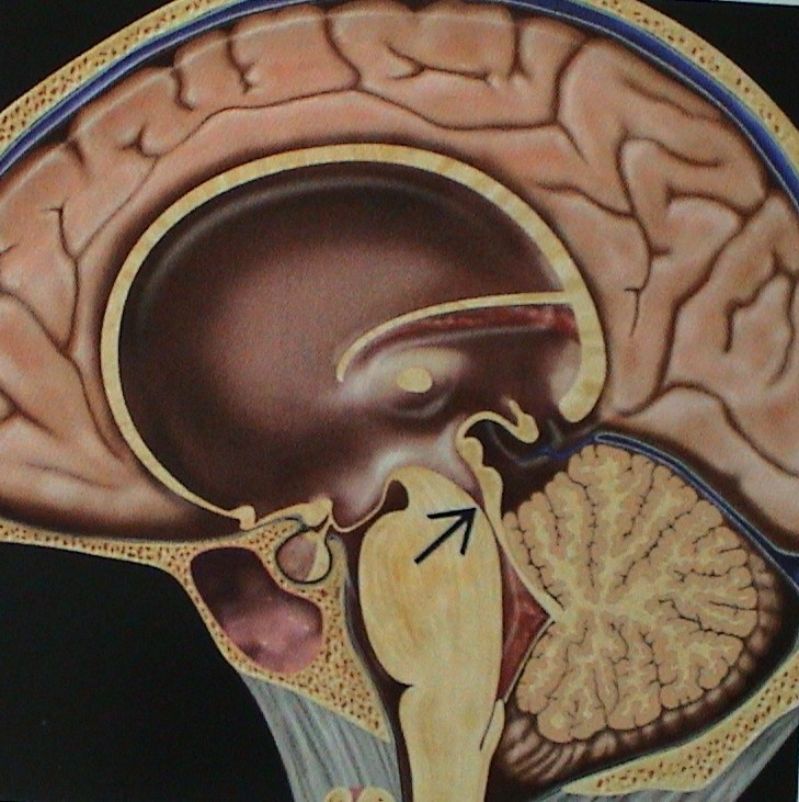 Surgery for problems arising in brain or Spine in children ( below 18 years).
several common problems like hydrocephalus ( accumulation of excess fluid in brain), tumors, spinal problems ( tethered cord- part of spine remains tethered )