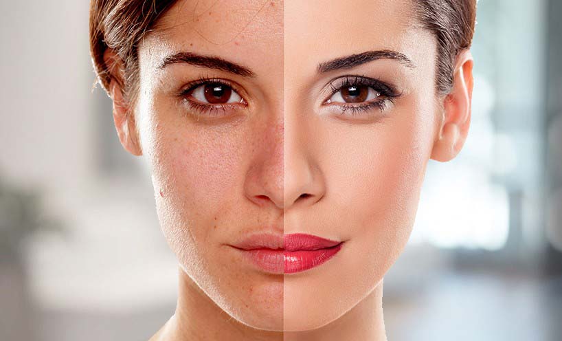 We cater the growing cosmetically conscious population dealing with the common skin needs such as, enhancement of normal skin, solutions for pimples, pimple scars, chicken pox scars, uneven skin tone, pigmentation, sun tan, hair fall, wrinkles and problems of aged skin, and all other skin diseases.
Skin Analysis
Hair Analysis
Pimple Treatment
Scar Reduction
Radiofrequency
Phototherapy
Allergy Testing
Vitiligo Surgery
Anti Aging Treatments