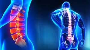 Spine Surgery By Dr Rajendra Latkar