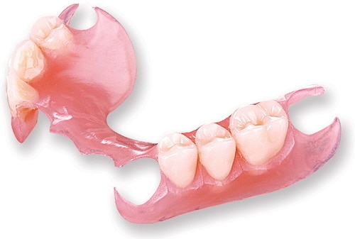 A removable partial denture is a denture for a partially edentulous patient who desires to have replacement teeth for functional or aesthetic reasons and who cannot have a bridge for any reason, such as a lack of required teeth to serve as support for a bridge or financial limitations.
