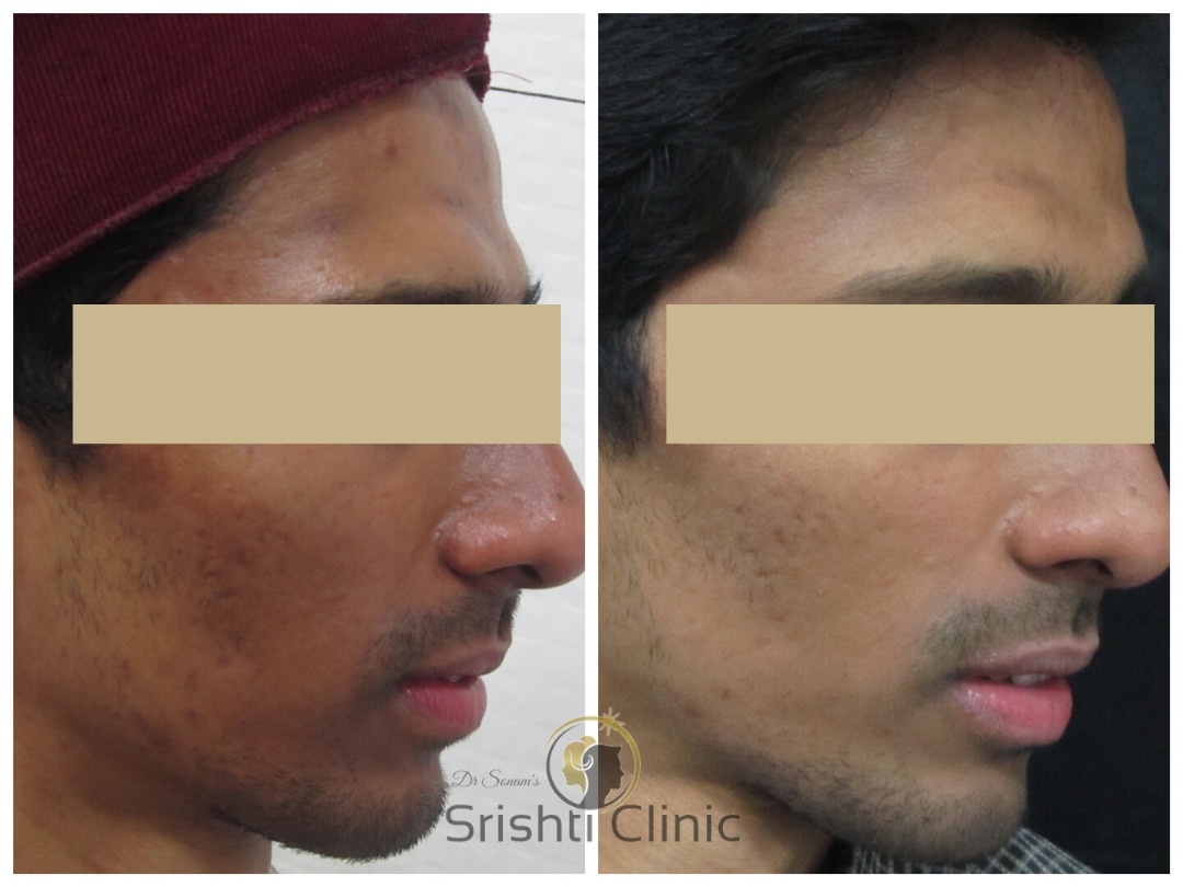 skin whitening treatment clinic near me