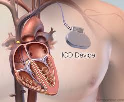 Device Implantations