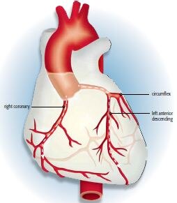Coronary & Peripheral Angiography