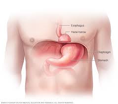 Laparoscopic operations