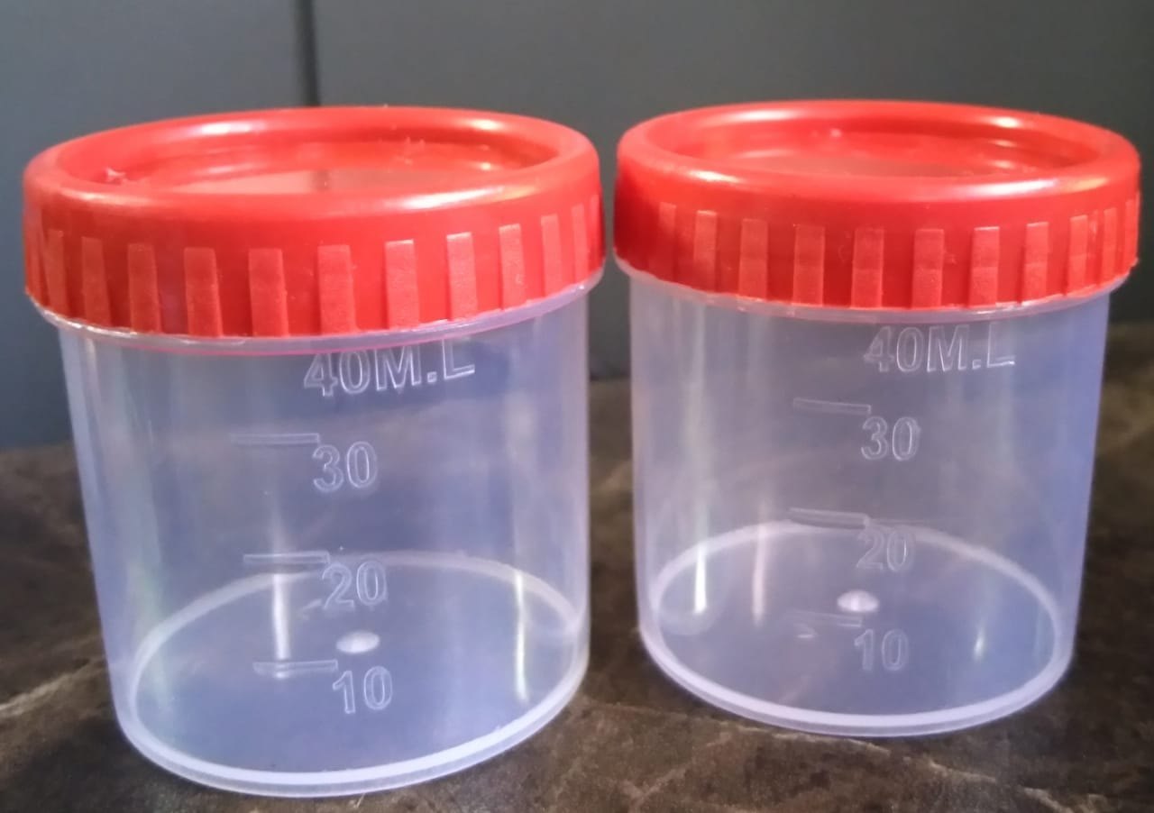Urine Specimen Container SUNPLAST INDUSTRIES, Jaipur