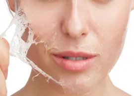 Chemical Peeling image 1
