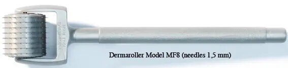 Dermaroller Treatment image 1