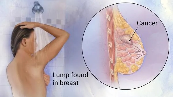 Breast Care Clinic image 1