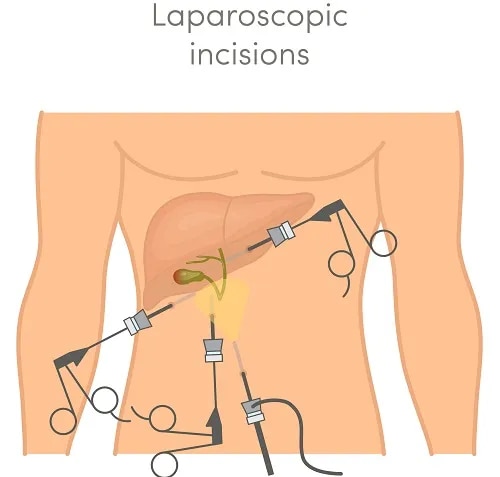 General & Laproscopic Surgery image 1