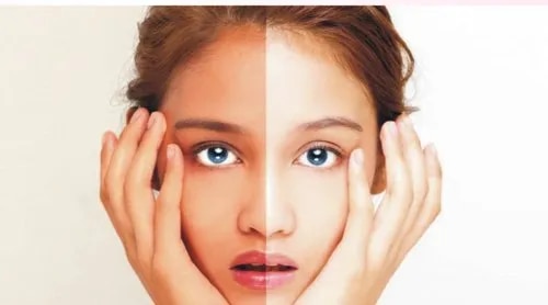 Glutathione Skin Whitening Treatment image 1