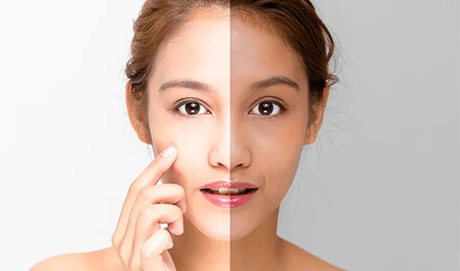 Skin Lightening image 1