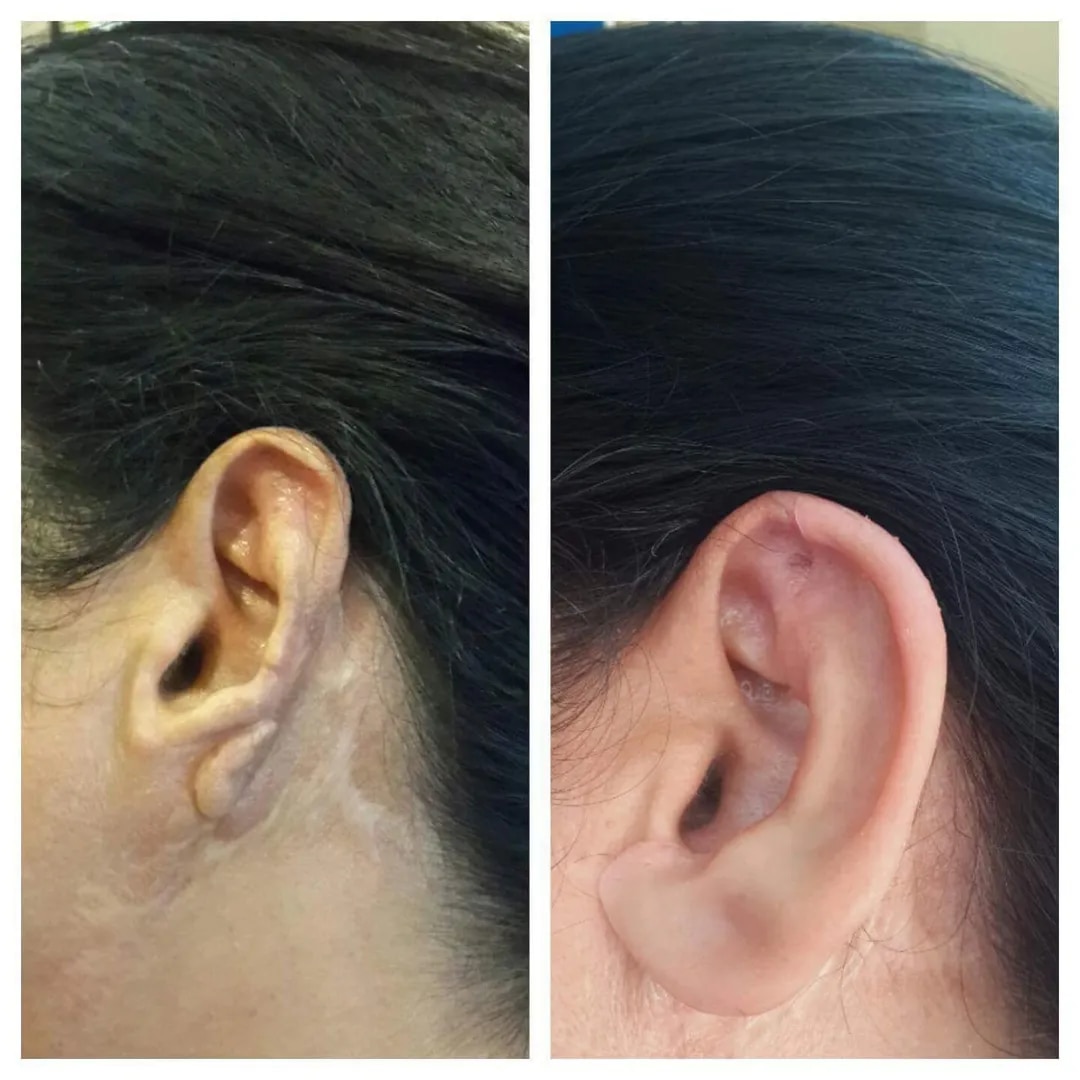 Cosmetic Restorations Thane image 1