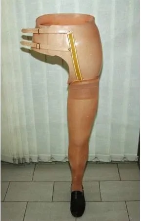 hip-disarticulation-prosthetic image 1
