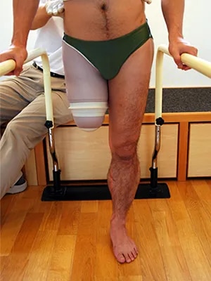 Above Knee image 1