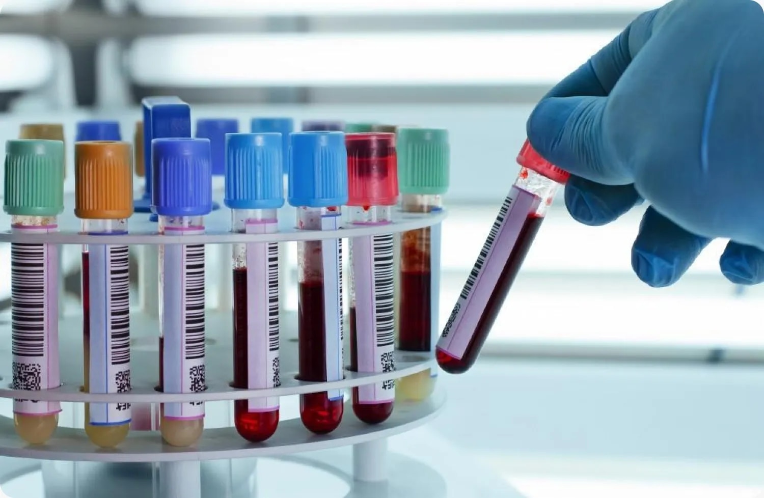 Blood Test Centre in Akurdi,Nigdi,PCMC image 1