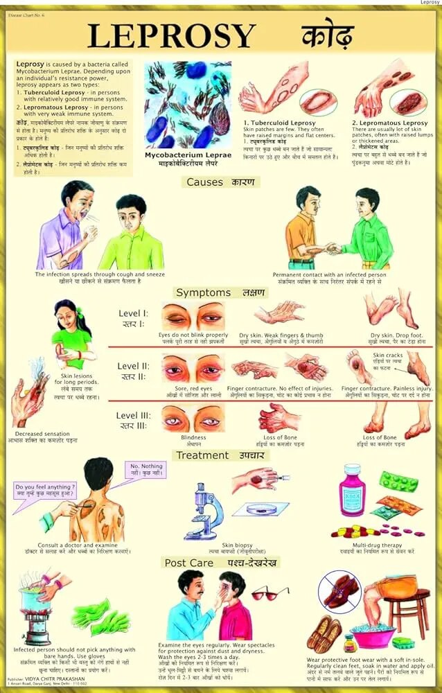 Immunization Chart (50x70cm) image 1