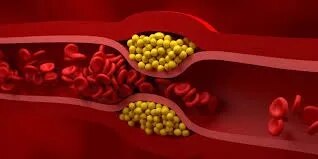 Cholesterol image 1
