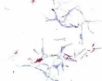 Carbol fuchsin Dilute (Ziehl-Neelsen) solution image 1