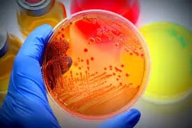 Microbiology image 1