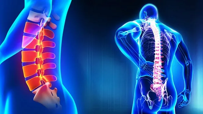 Spine Surgery By Dr Rajendra Latkar image 1