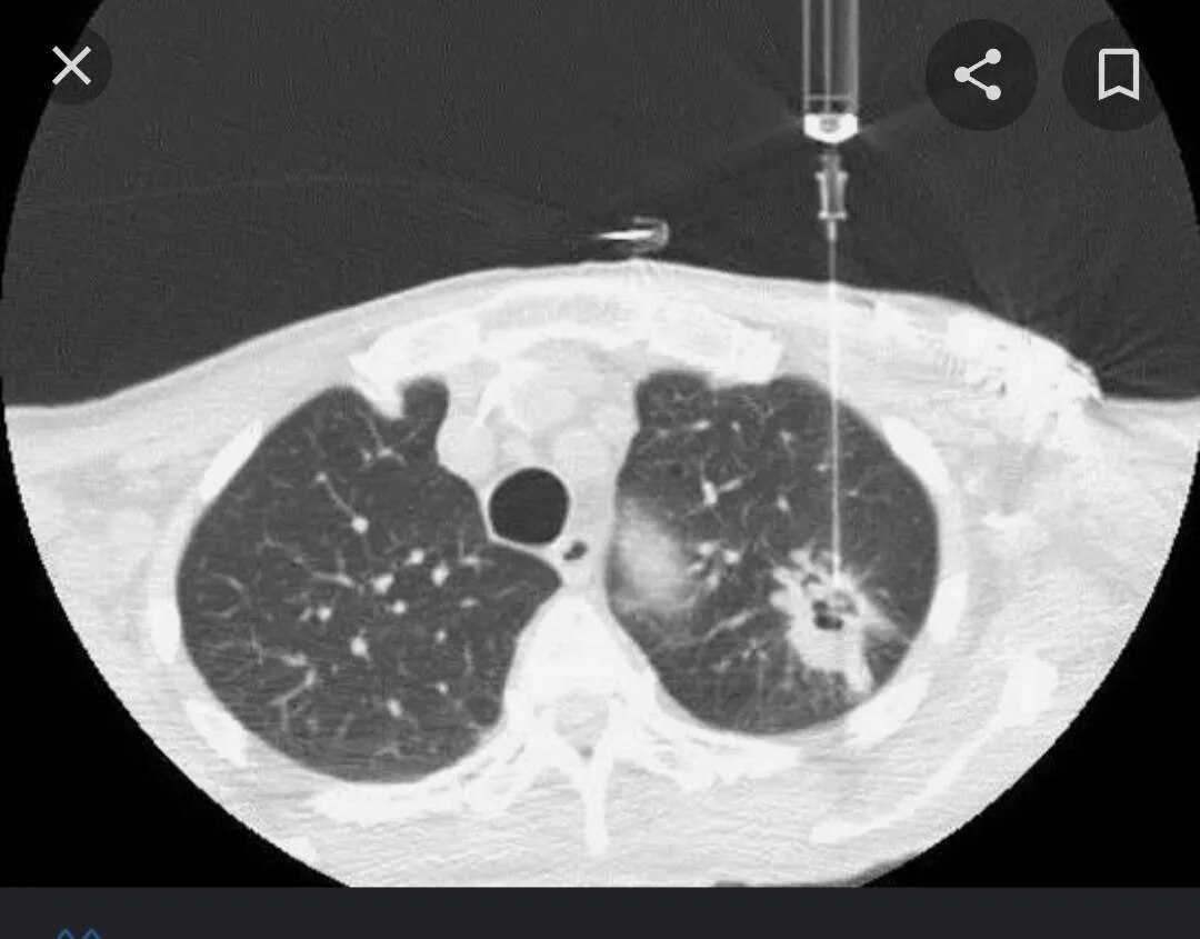 Interventional Radiology  image 1