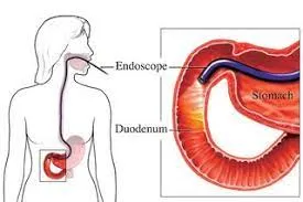 Endoscopy image 1