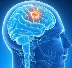 Neuro Surgery image 1