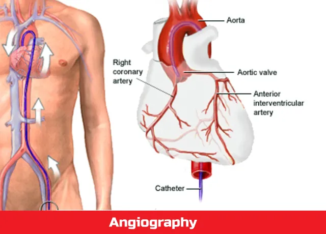 Coronary Angiography Hospital in PCMC,Pune image 1