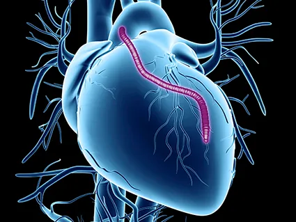Cardiac/Bypass Surgeon in PCMC,Pune image 1