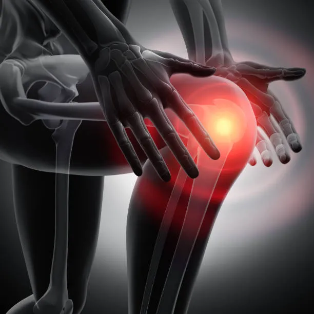 Total Knee Replacement image 1