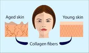 LASER COLLAGEN REMODELLING image 1