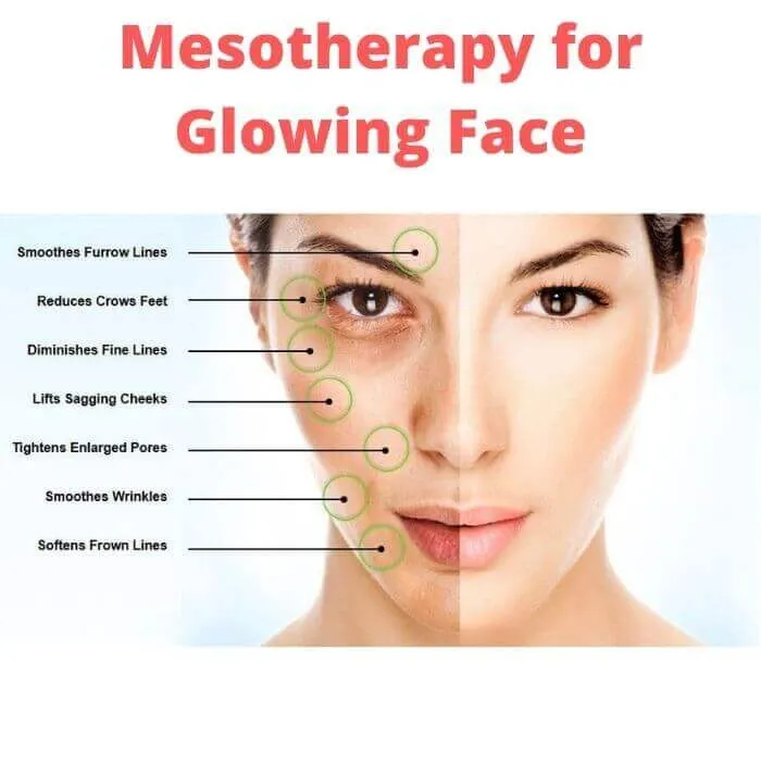 MESOTHERAPY image 1