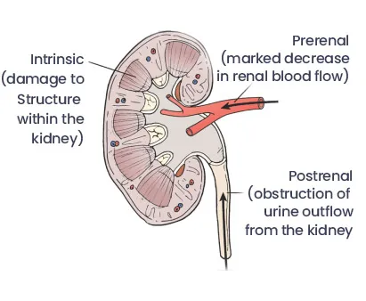 Kidney Disease Treatment image 2