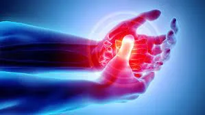 ARTHRITIS image 1