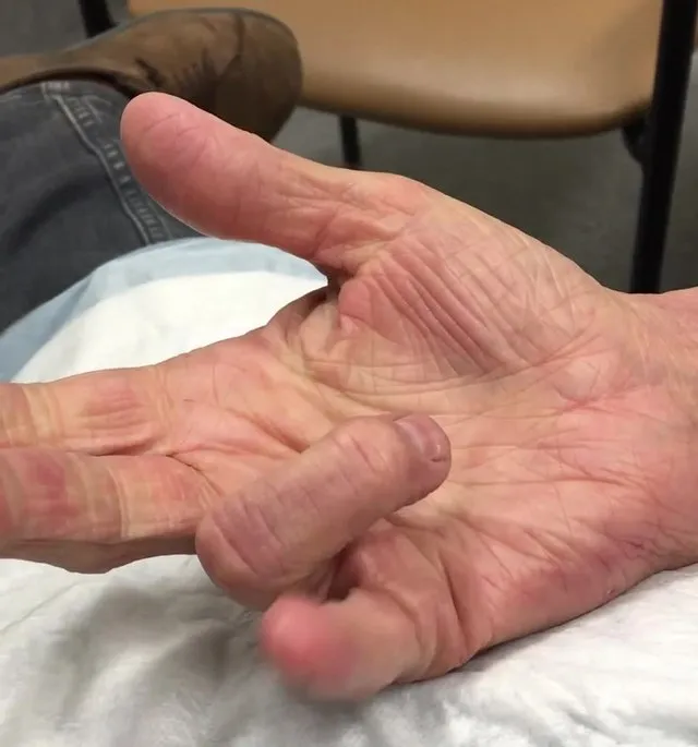 Chronic Bone & Joint Pain image 5