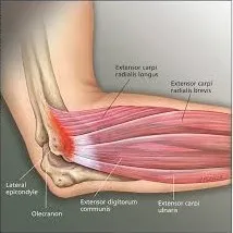 Chronic Bone & Joint Pain image 1