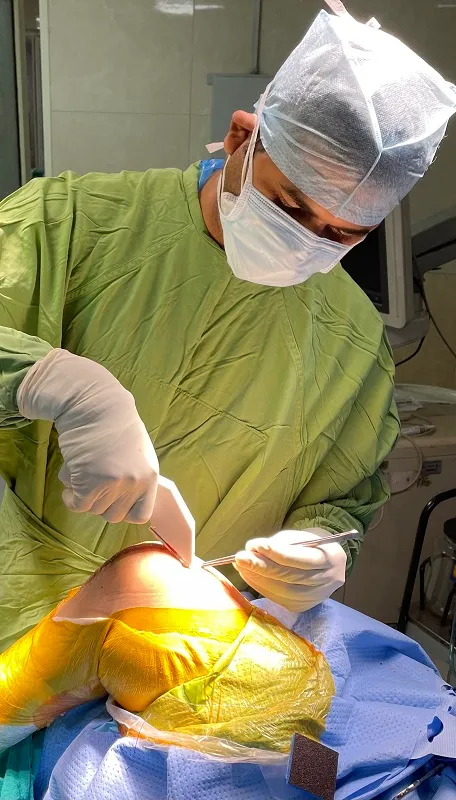 Total Knee Replacement image 2