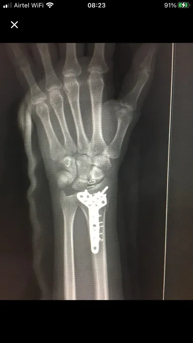 FRACTURE AND COMPLEX TRAUMA image 6