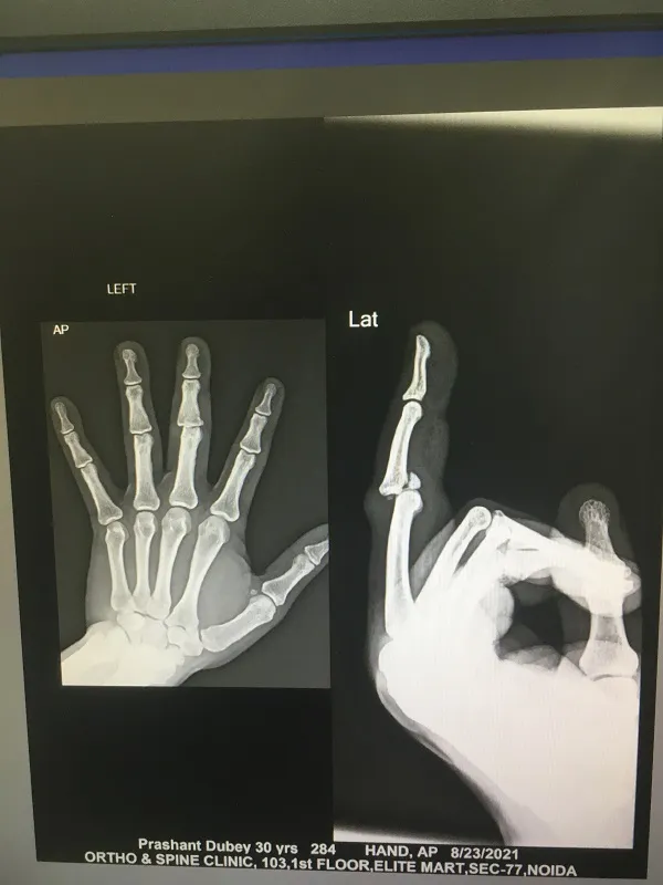 FRACTURE AND COMPLEX TRAUMA image 8