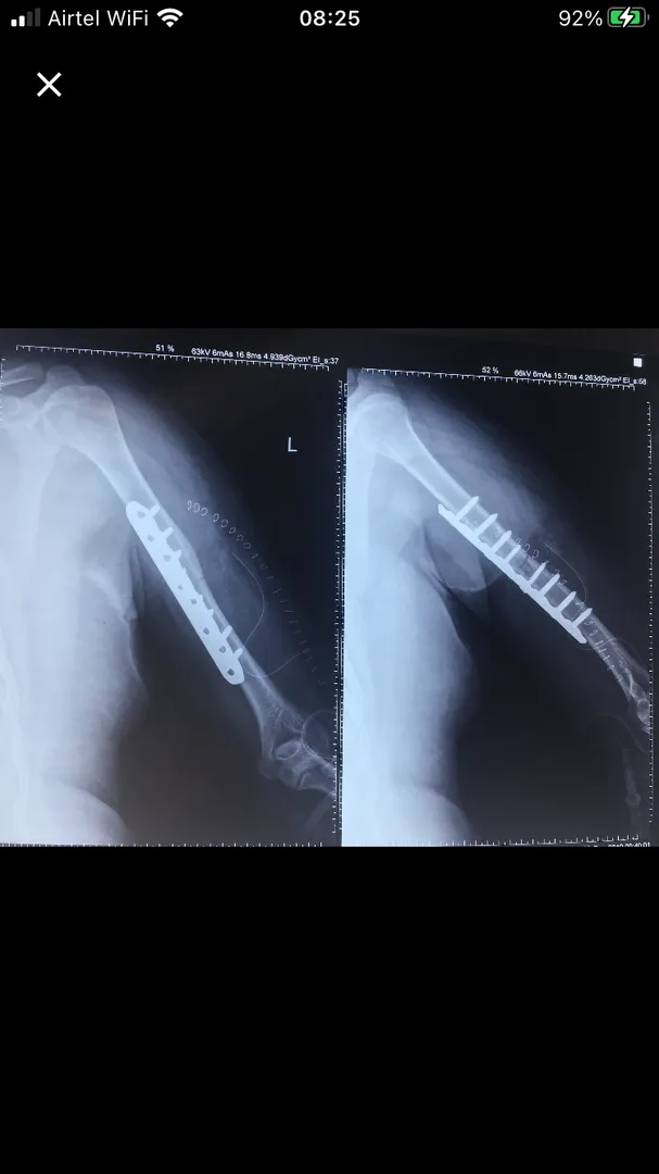 FRACTURE AND COMPLEX TRAUMA image 2