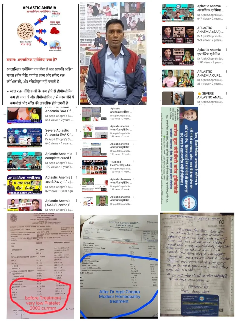 Aplastic Anaemia Treatment अप्लास्टिक एनीमिया  image 1
