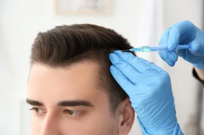 Hair Transplant image 1