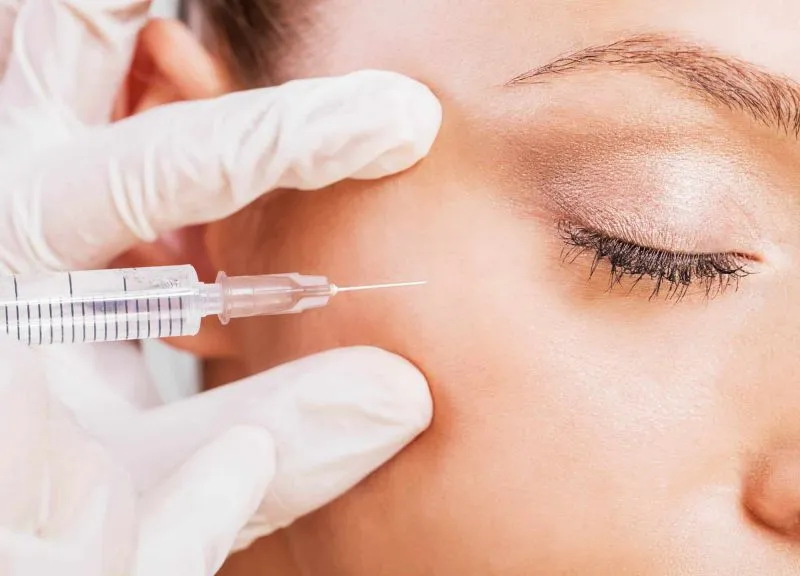 Under-eye Rejuvenation image 1